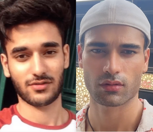 The Story of Salludon: The Transformation That Captivated the Internet